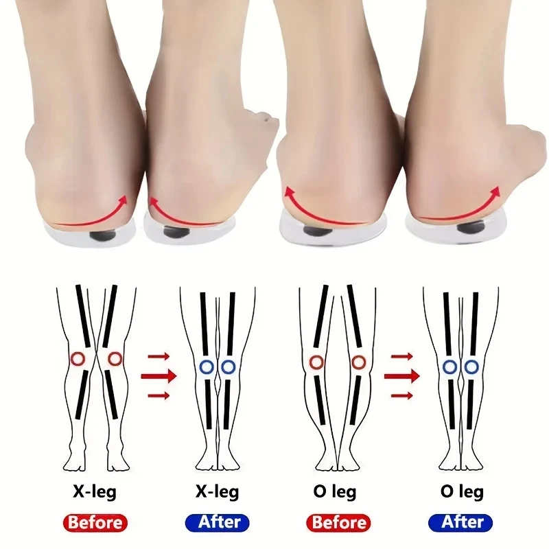 Women Shoes Types - 1 para wkładek ortopedycznych do stóp